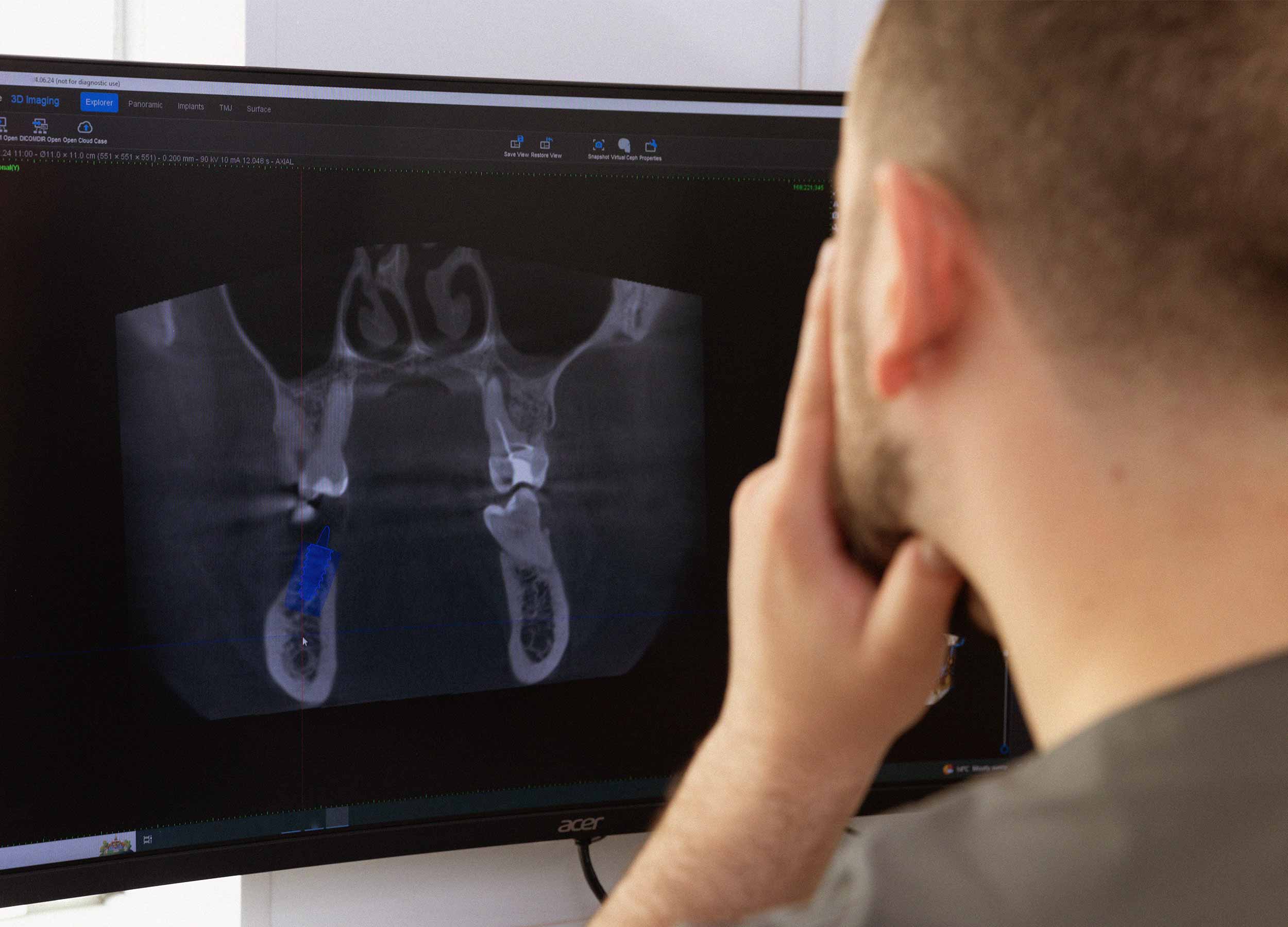 Visual of scan being reviewed by dental professional